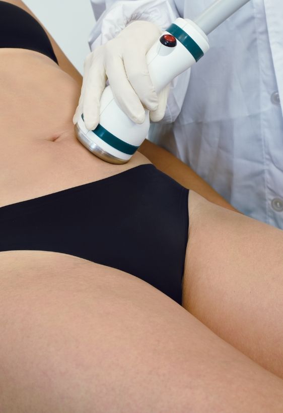 Onda-Trattamenti-DEKA-LASER