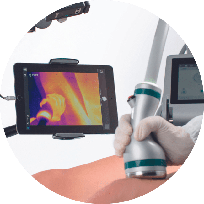 Onda-plus-thermal-view-DEKA