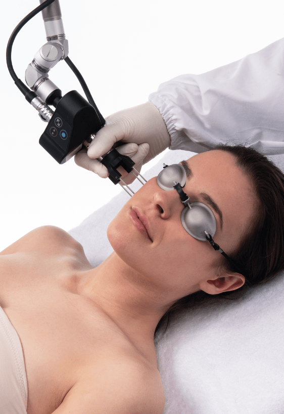 SmartXide-Punto-Derm-DEKA-LASER